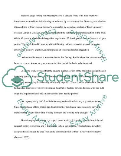 How Brian Imaging Could Help Predict Alzheimers