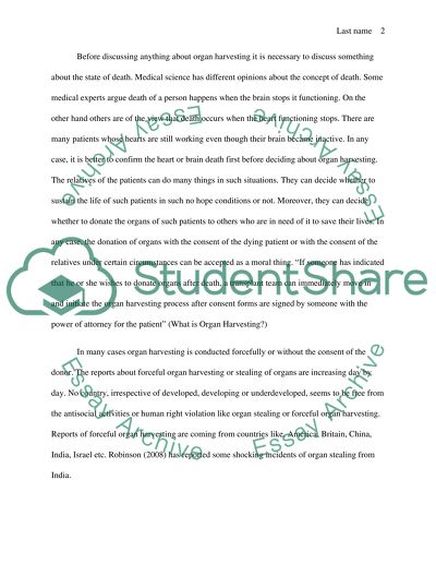 Organ Harvesting Practice Issues