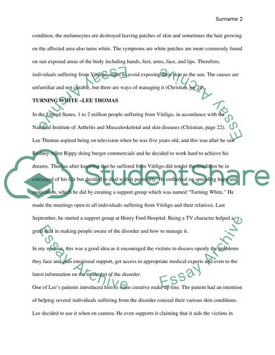 Turning White by Lee Thomas