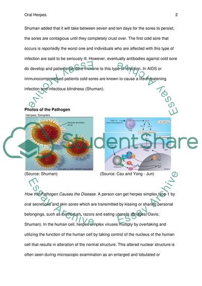 Signs and Symptoms of the Disease Oral Herpes