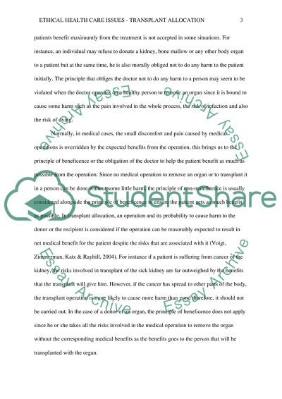 Principle of Transplant Allocation