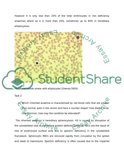Hemolytic Disorders: Hereditary Elliptocytosis
