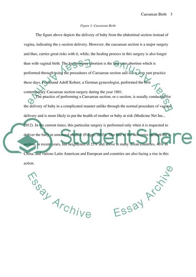 All Women Should Have the Right to Caesarean Birth, Even if There Is No Medical Need