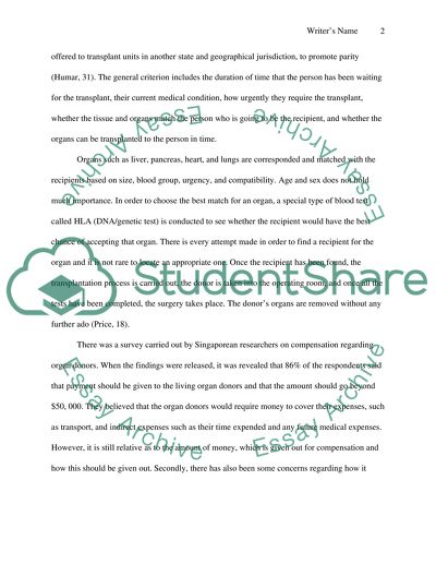 Organ Donation- How recipients are chosen and should donors be compensated