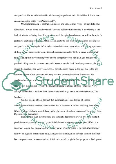 Spine thesis topics picture