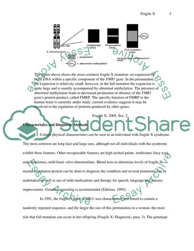 Fragile X Syndrome and Its Impact on Childrens Language
