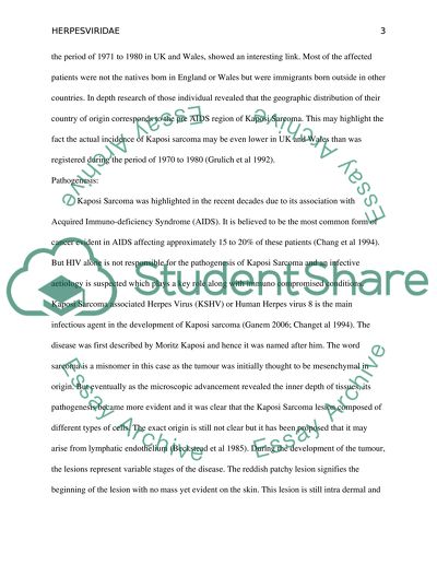 HIV Related Kaposi Sarcoma