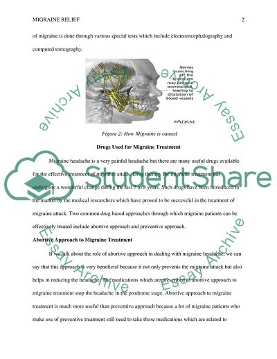 Prescription Drugs versus Alternative Treatments for Migraine Relief