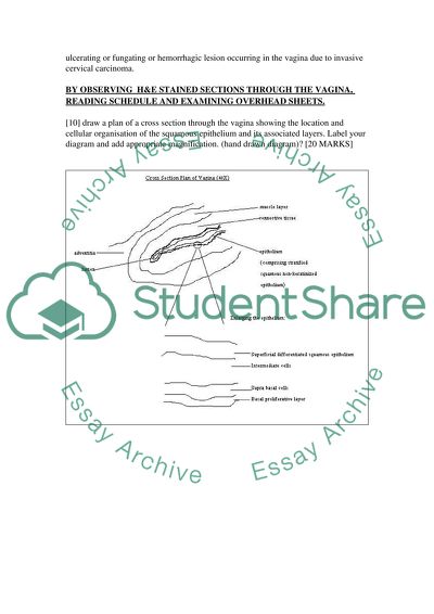 Pathological normalcy meaning image