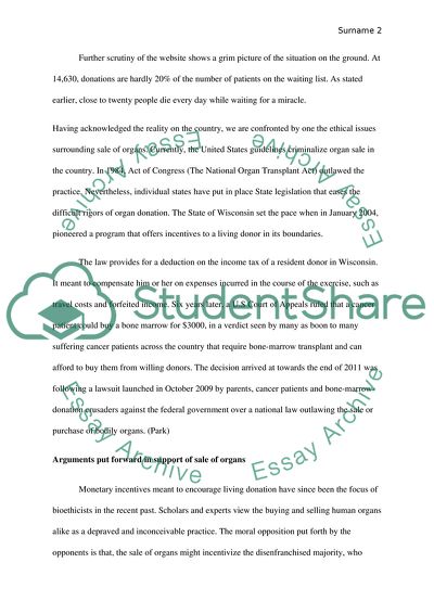 Should Organ Donors Be Paid For Their Organs