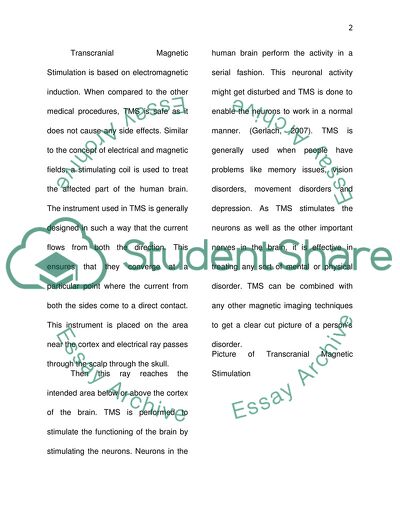 Transcranial Magnetic Stimulation