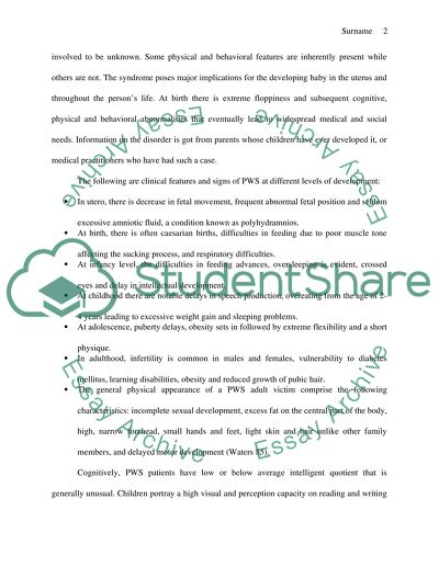 Celebrities with prader willi syndrome picture