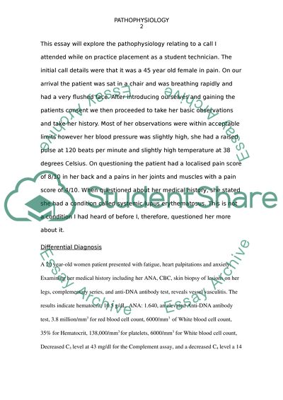 Pathophysiology of Systemic Lupus Erythematosus