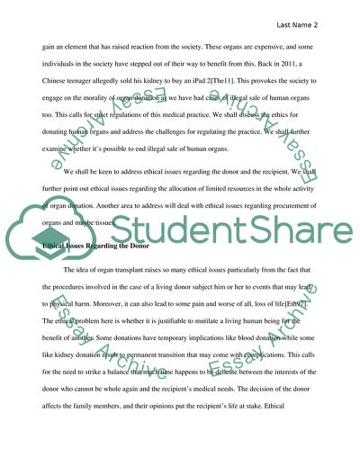 Organ Transplantation: Ethical Issues, Regulation and Illegal Sales of Human Organs