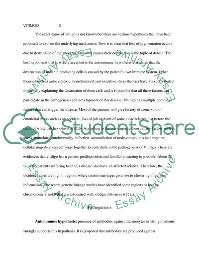 Vitiligo: Causes and Treatment