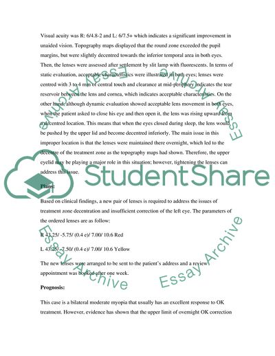 Bilateral Keratoconus in a Young Albinism Male