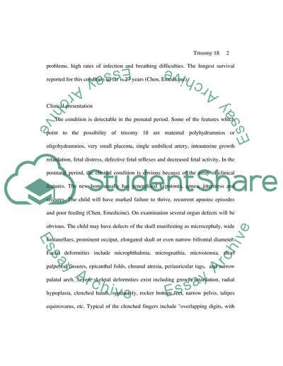 Edward Syndrome or Trisomy 18