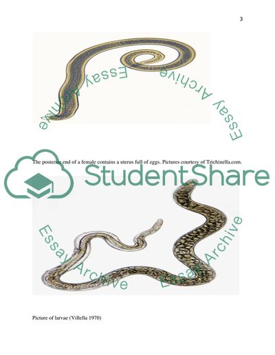 Analyzing Trichinella Spires Infection