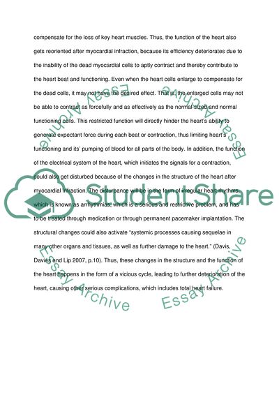 Heart Failure as a Possible Complication of a Myocardial Infarction