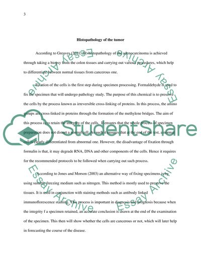 Discuss the role of histopathology in the diagnosis and prognosis of adenocarcinoma of the colon