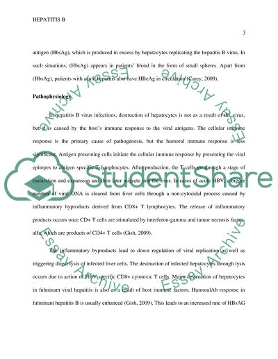 Fulminating Hepatitis B secondary to a lifetime use of IV drug abuse