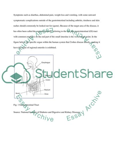 Tissue Pathology: Crohns Disease