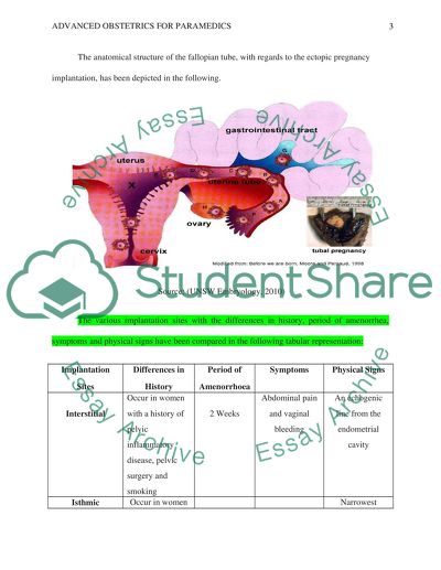 Advanced Obstetrics: Thromboembolic