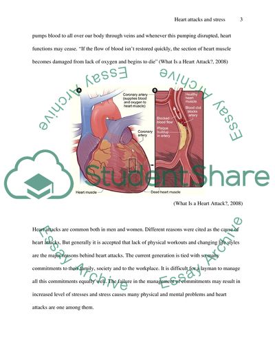 Heart attacks and stress