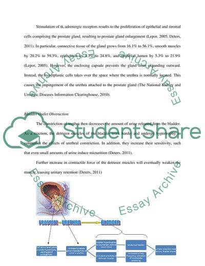 Anatomy of Prostate Gland
