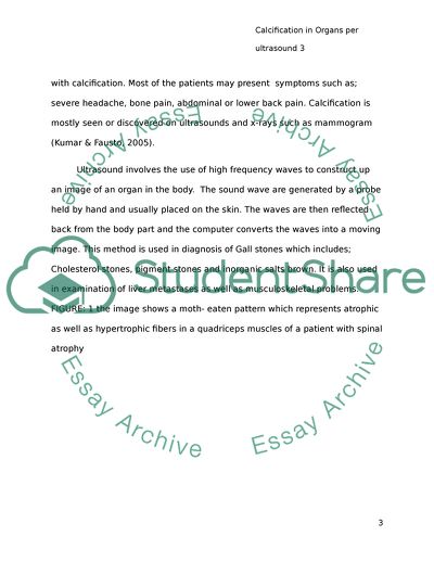 Calcification in Organs per Ultrasound