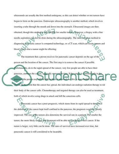 Stages of Pancreatic Cancer
