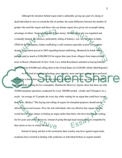 Buying and Selling Organs for Transplantation