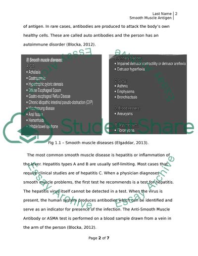 Smooth Muscle Antigen