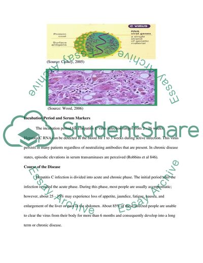 Hepatitis C Infection