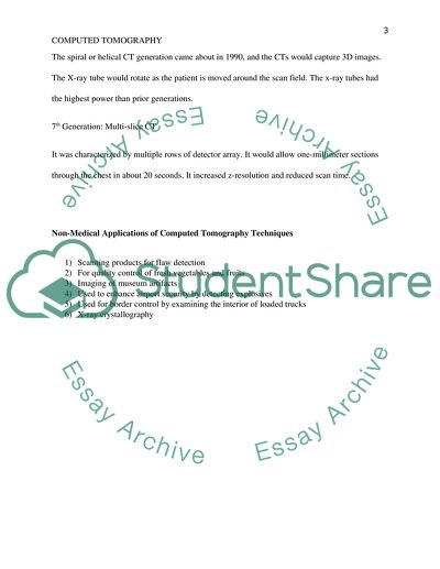 Different Generations of X-ray CT