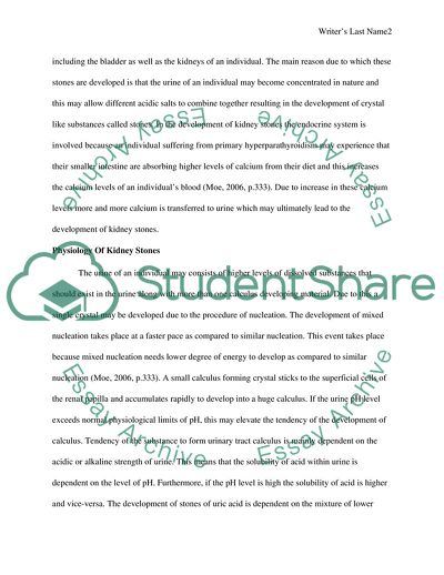 Symptoms of Kidney Stones