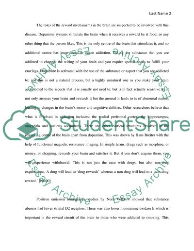 Addiction is a Brain Disease