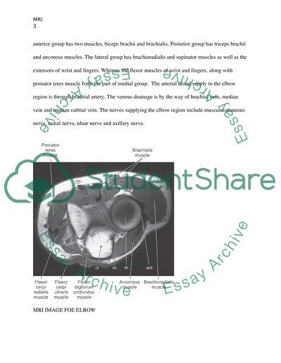 Elbow as the Joint of the Upper Limb