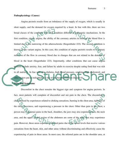 Prinzmetal angina image