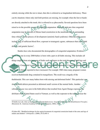 Children Born as Amputees from Amniotic Band Syndrome