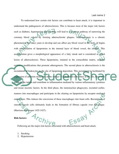 What factors are most important to know in terms of preventing heart attack