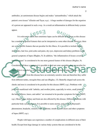 The Feature of Systemic Lupus Erythematosus
