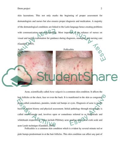Dermatological Conditions: Acne Ulgaris, Rosacea, Eczema, and Seborrheic Dermatitis