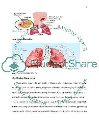 introduction for lung cancer essay