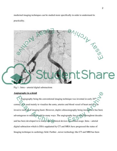 The Subject of Angiography