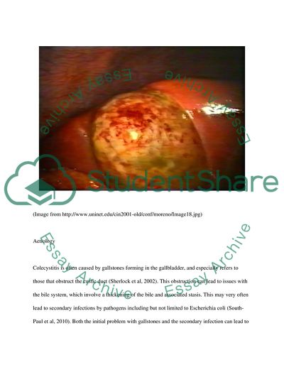 Cases of Bile Duct Blockage and Subsequent Acute Cholecystitis
