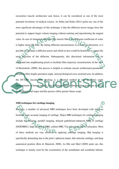 Diffusion Tensor Imaging
