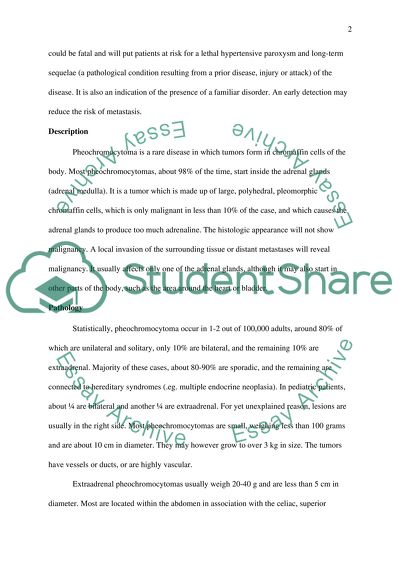 Treatment and Management of Pheochromocytoma
