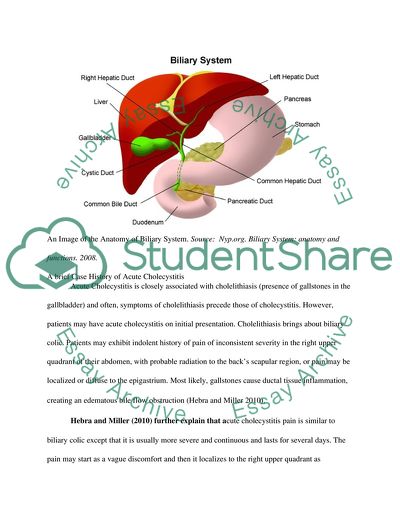 Anatomy of Biliary System