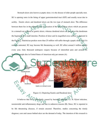 Causes of Stomach Ulcer